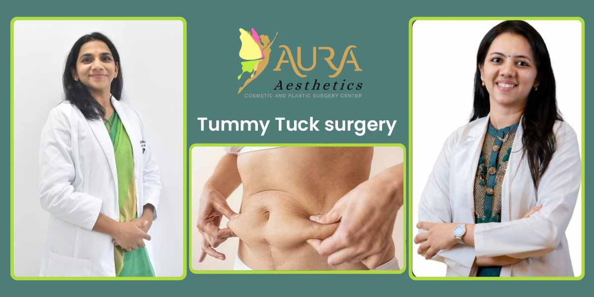Tummy Tuck Surgery in Hyderabad – Safe & Trusted Care