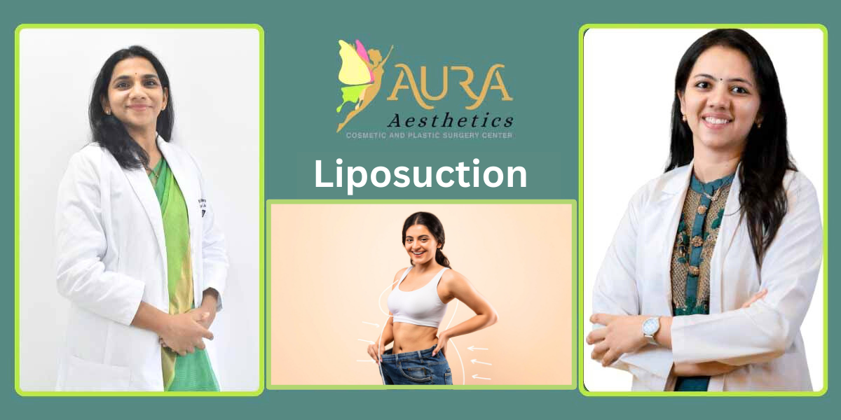 Liposuction In Kokapet – Safe Body Contouring Care